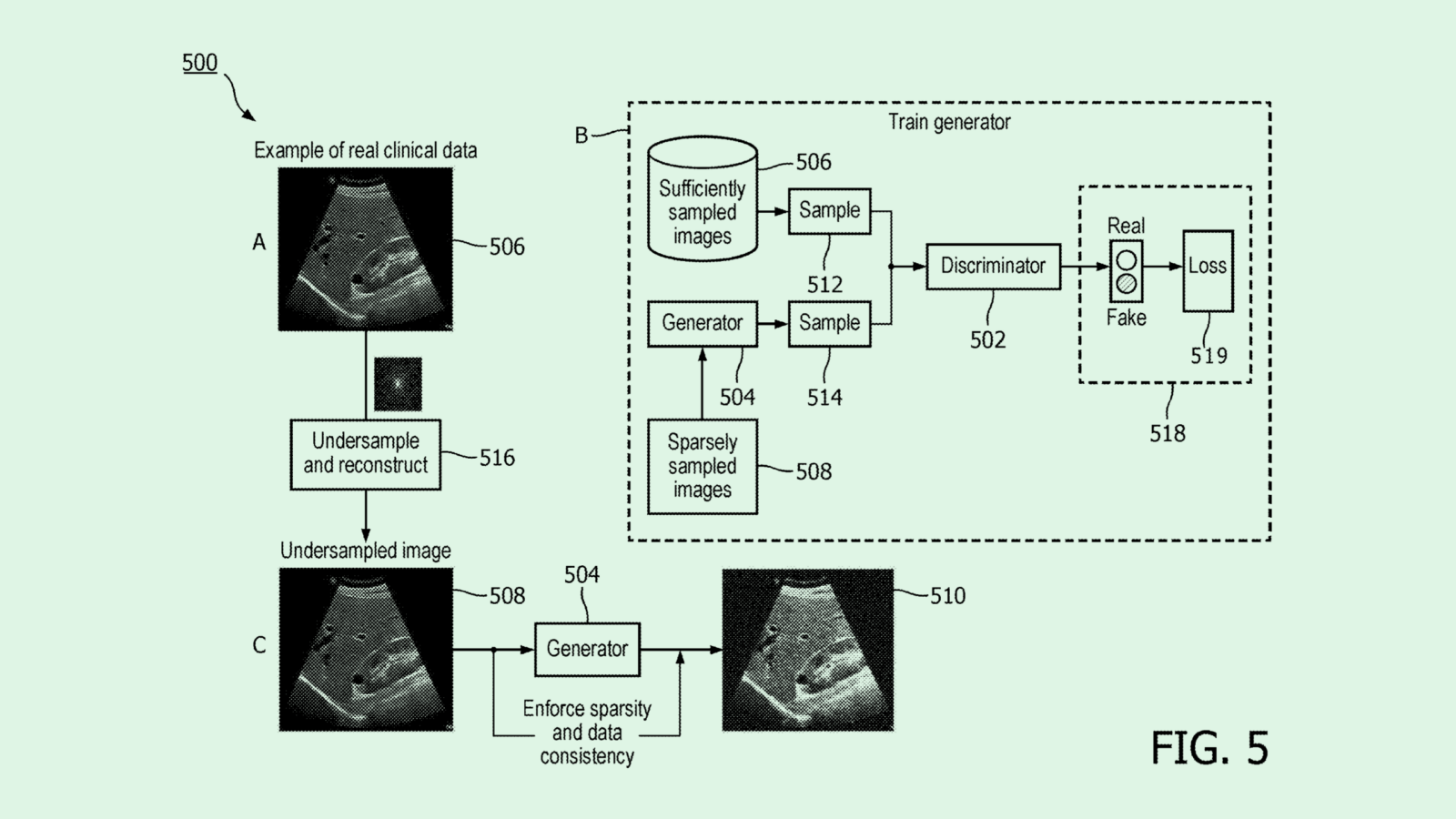 Philips’ AI Ultrasound Patent Could Help Solve Healthcare Data Problem