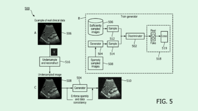Philips’ AI Ultrasound Patent Could Help Solve Healthcare Data Problem