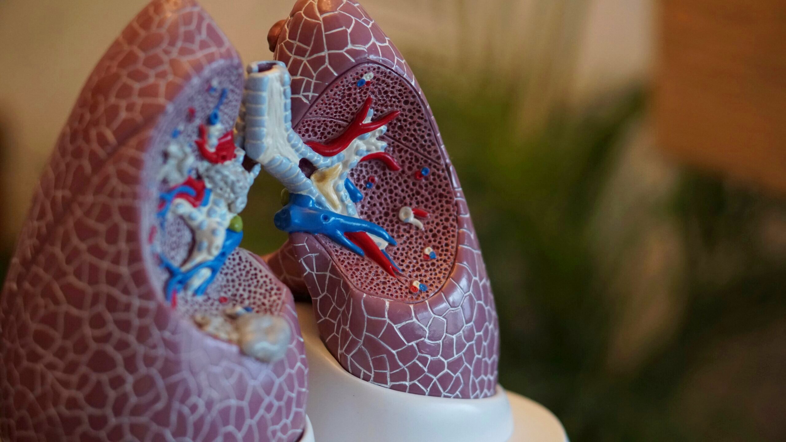 An anatomical model of the human lungs is shown.